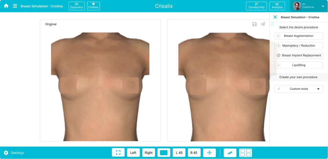 Redesign Breast Simulator